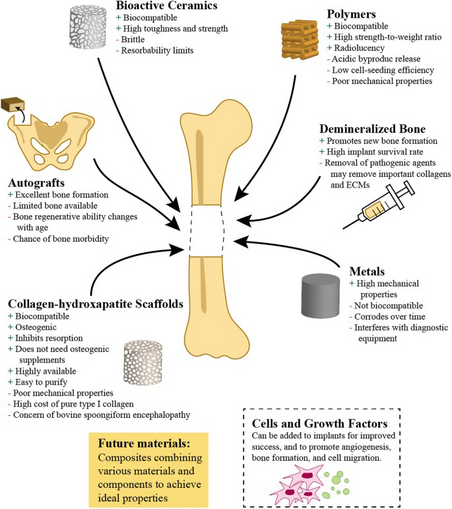 Healing of bony defects is a unique challenge due to the complex mechanical properties, irregular shapes, and critical size of missing bone. Bone defects that require surgery are typically caused by significant missing portions of bone and the methods of repair involve surgical implantation of a biomaterial. The gold standard for this repair is the use of autografts, but these can lead to bone morbidity. Alternatives include allografts and xenografts; however, multiple challenges associated with their use motivate tissue engineering efforts. To date, a wide spectrum of efforts have explored the design of osteogenic or osseoinductive biomaterials such as polymers, metals, and ceramics. Increasingly, efforts have also explored alternative fabrication approaches to create patient-specific implants. These efforts include adaptation of generative design principles and 3D printing to create unique geometries, methods to incorporate exogenous cell sources, and the use of conventional and exotic growth factor patterning and release approaches to further improve biological response. Here, we discuss the mechanisms of bone repair, the current available technologies, biomaterial design criteria, 3D printing as a fabrication method, and the influence of cells and growth factors on bone repair.