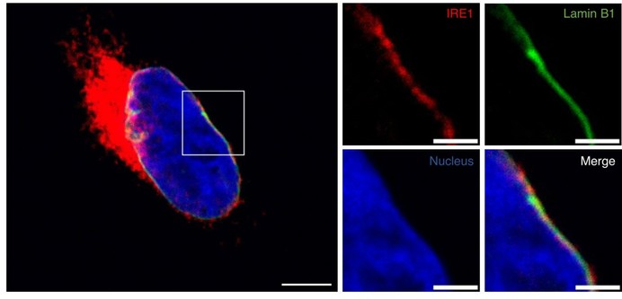 Detection of endogenous Halo-tagged IRE1 and non-tagged Lamin B1 by confocal microscopy. U2OS HaloTag cells, containing a C-terminal HaloTag into the endogenous IRE1 gene locus, were examined. Cells were cultured in the presence of Janelia 646 HaloTag ligand (green), fixed, stained with anti-Lamin-B1 (red) antibodies, and analyzed by confocal microscopy. Left: Merge field of IRE1 (red), Lamin B1 (green), and nucleus (blue) is shown. Scale bar = 5 μm. Right: Close up of the nuclear envelope where each channel is shown separately and merged. Scale bar = 2 μm. Pixel size = 48 nm. Representative image of two independent experiments shown.