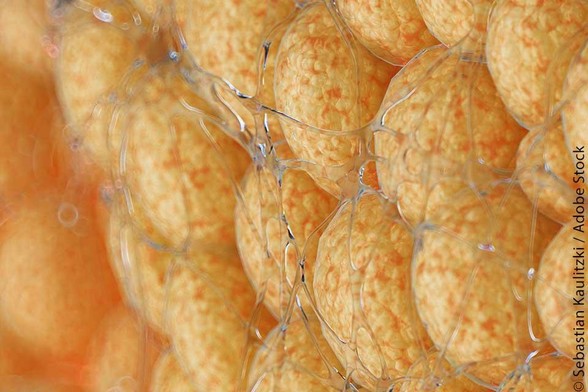 yellow fat cells