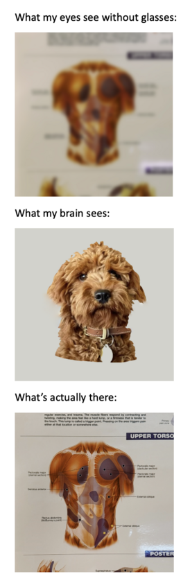 Three photos of images that are similar in broad outline and colouring and shapes.

The first is labeled "What my eyes see without glasses", and shows a blurry image that could resolve to either of the other two.

The second is labeled "What my brain sees" and is front-view a picture of a cute, furry dog's head (a "red", which is actually a shade of brown, haired Cavoodle).

The third is labeled "What's actually there" - it is an anatomical muscle diagram of a human torso that a massage therapist uses. (The shoulders and upper arms correspond to the dog's ears. The exact details of the darker and lighter areas on the diagram match up broadly to the dog's eyes and nose.)