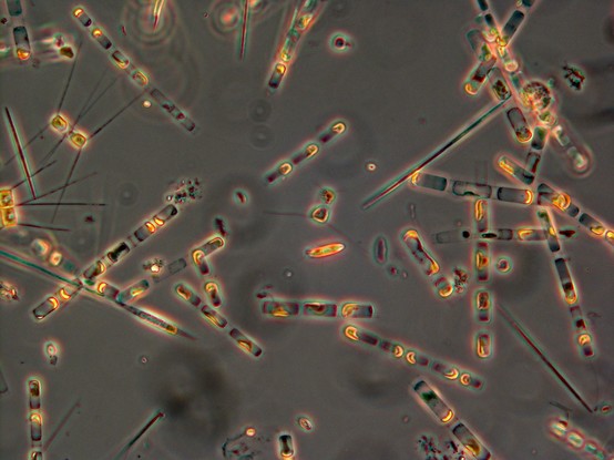 Diatoms as seen through a microscope