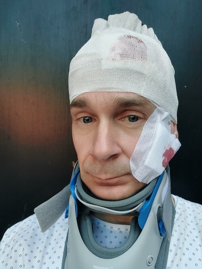 Selfie de votre serviteur en malade pour Groland, pansements avec un peu de sang et minerve, j'ai retrouvé la vue mais ai perdu l'usage de mes jambes...