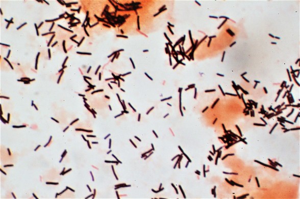 Gram stain of lactobacilli and squamous epithelial cells in vaginal swab.

https://commons.wikimedia.org/wiki/File:Lactobacilli_(Gram_stain).jpg