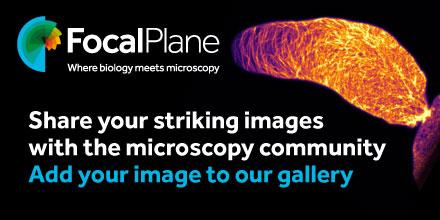 Share your striking images with the microscopy community.
Add your image to our gallery.