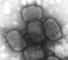 Picture of virus under an electron microscope.
