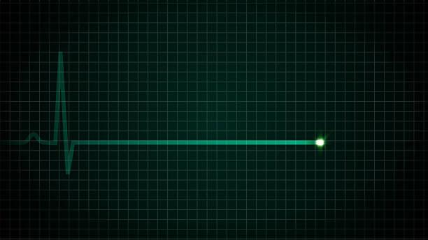 A heart monitor display suddenly goes flat.
