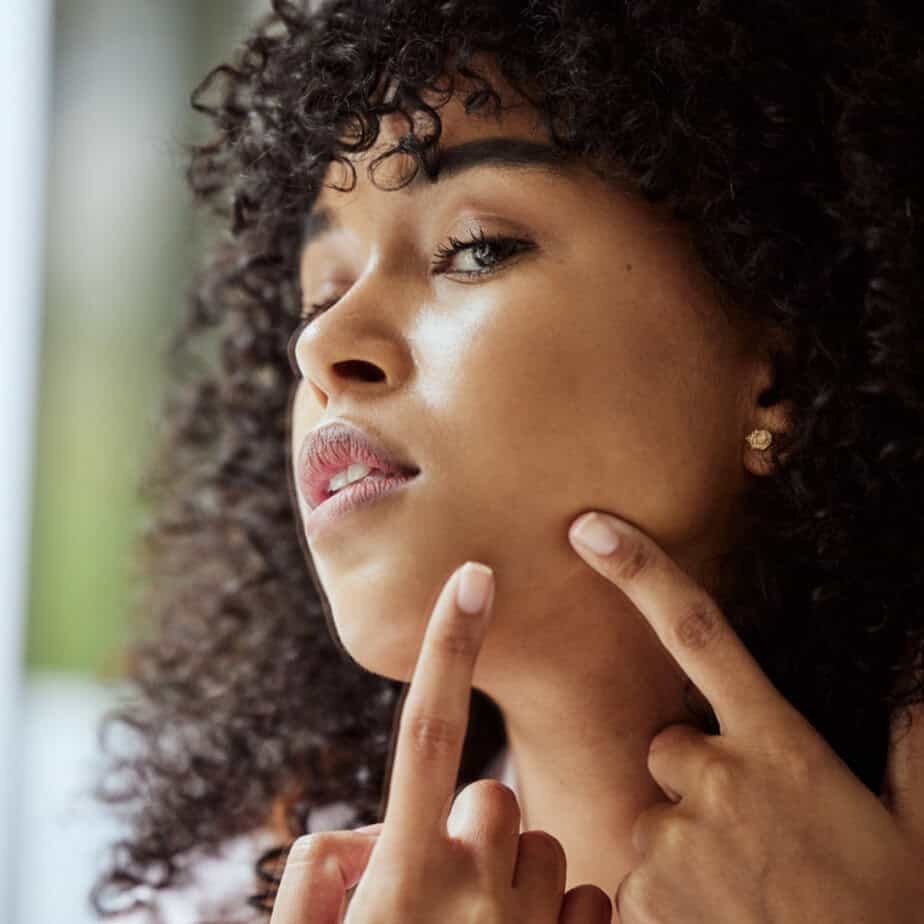 Skin Purging vs. Breakouts: How To Spot the Difference and What To Do Next