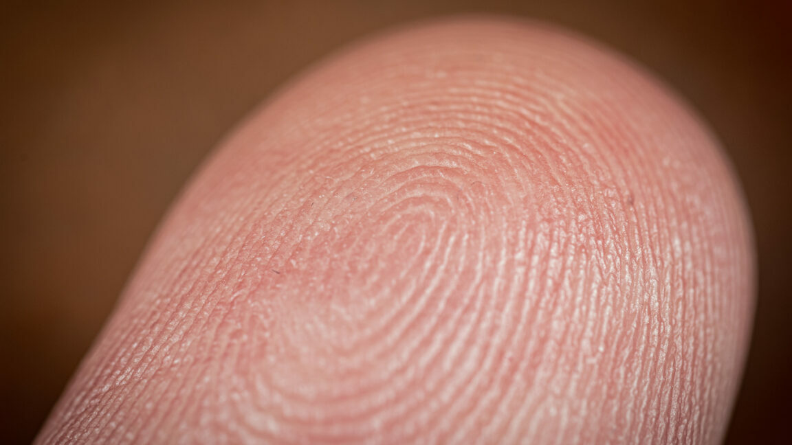 Photo of a finger.