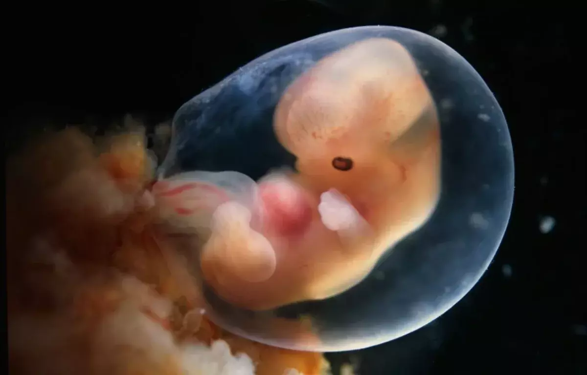 Advanced amniotic sacs created from stem cells