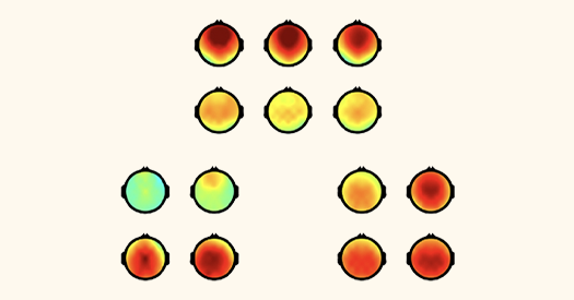 Research image of EEG scans showing dopamine levels in human brains. Research image of EEG scans showing dopamine levels in human brains.