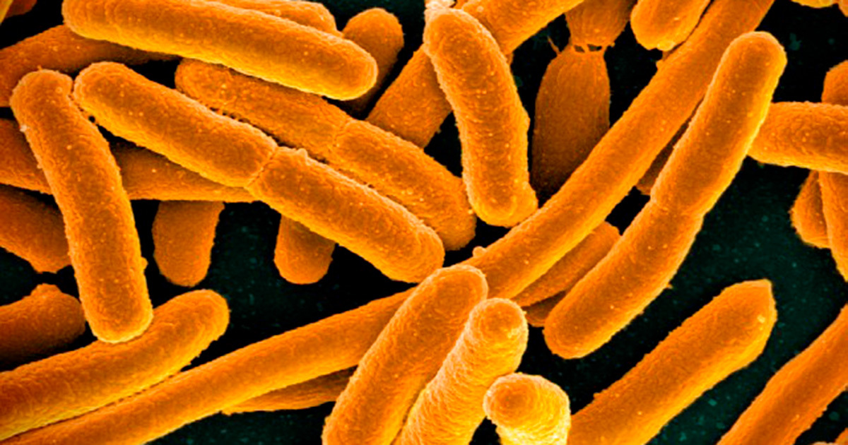 Ilustração de Escherichia coli, em laranja, com fundo verde escuro