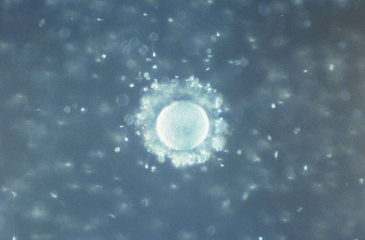 A human egg surrounded by sperm, in a photo magnified 400 times. | Clouds Hill Imaging Ltd. (Getty Images)