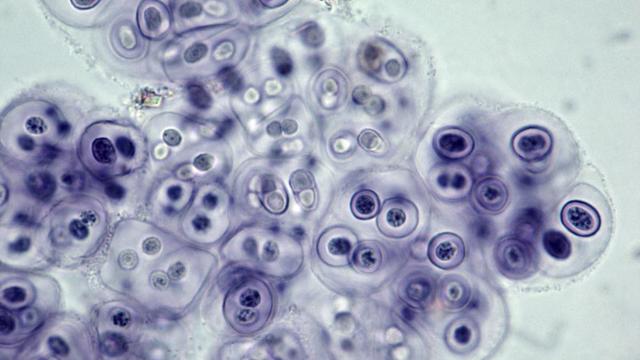 Una bacteria desde un telescopio. / Ed Reschke