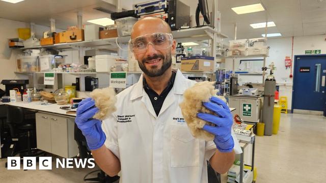 Dr Sherif Elsharkawy wearing blue gloves, white lab jacket and goggles, holds two clumps of blond hair in a laboratory