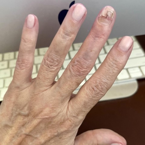 iPhone photo of my fingernails--all but one are painted pale pearly beige. Part of my left hand is visible & my desktop computer is in the background 